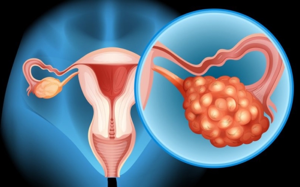 Cytoreductive Surgery